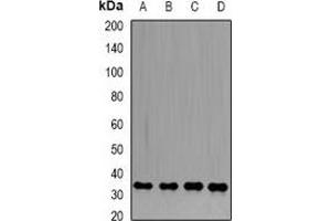 Western blot analysis of PP1 beta expression in HL60 (A), PC3 (B), Hela (C), mouse heart (D) whole cell lysates. (Serine/threonine-Protein Phosphatase PP1-beta Catalytic Subunit (PP1-BETA) anticorps)