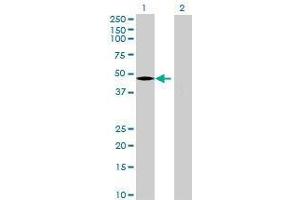 Lane 1: PCYOX1L transfected lysate ( 46. (PCYOX1L 293T Cell Transient Overexpression Lysate(Denatured))