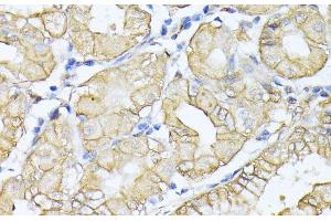 Immunohistochemistry of paraffin-embedded Human stomach using SPTAN1 Polyclonal Antibody at dilution of 1:100 (40x lens).