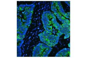 IF analysis of Cytokeratin 8 using anti-Cytokeratin 8 antibody (ABIN6719478). (KRT8 anticorps  (AA 107-325))