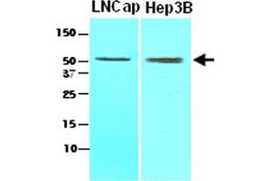 Cell lysates of LNCap (lane 1), Hep3B (lane 2) (30 ug) were resolved by SDS-PAGE, transferred to NC membrane and probed with ACOT11 monoclonal antibody, clone J4B2  (1:1000). (ACOT11 anticorps  (AA 19-250))