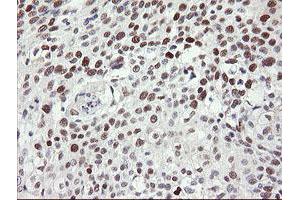 Image no. 21 for anti-Transducin-Like Enhancer of Split 1 (E(sp1) Homolog, Drosophila) (TLE1) (AA 180-460) antibody (ABIN1491050)