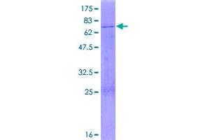 Image no. 1 for Pyruvate Dehydrogenase (Lipoamide) alpha 2 (PDHa2) (AA 1-388) protein (GST tag) (ABIN1314520)