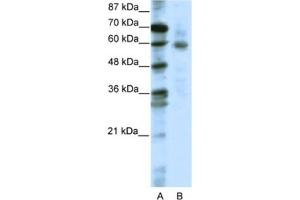 Western Blotting (WB) image for anti-Forkhead Box O1 (FOXO1) antibody (ABIN2461644) (FOXO1 anticorps)