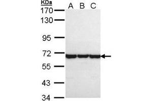 TCP1 theta Antibody staining of A431 (A), H1299 (B), HeLa (C) whole cell lysates (30 µg) at 1/1000 dilution, 7. (CCT8 anticorps  (AA 111-327))