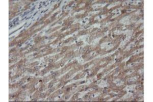 Image no. 5 for anti-Mitogen-Activated Protein Kinase Kinase 3 (MAP2K3) antibody (ABIN1499403)