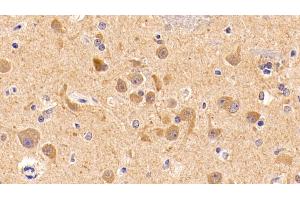 Detection of IGF1 in Human Cerebrum Tissue using Monoclonal Antibody to Insulin Like Growth Factor 1 (IGF1)