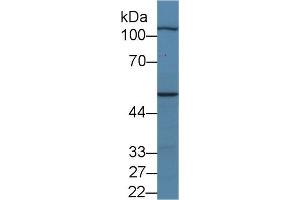 Detection of MYPN in Porcine Skeletal muscle lysate using Polyclonal Antibody to Myopalladin (MYPN)