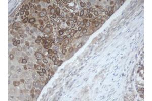 Image no. 1 for anti-Melanoma Antigen Family B, 1 (MAGEB1) antibody (ABIN1499266)