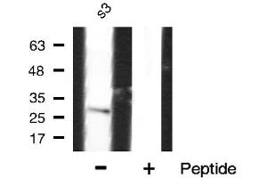 Western blot analysis of Interleukin 1β expression in S3 lysate (IL-1 beta anticorps  (Internal Region))