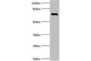 Western blot All lanes: Cartilage oligomeric matrix protein antibody at 4 μg/mL + Mouse skeletal muscle tissue Secondary Goat polyclonal to rabbit IgG at 1/10000 dilution Predicted band size: 83, 78 kDa Observed band size: 83 kDa (COMP anticorps  (AA 20-160))