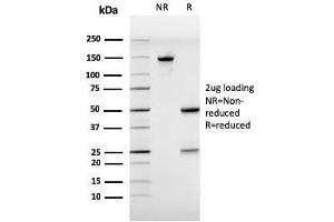 SDS-PAGE Analysis Purified Estrogen Receptor alpha Mouse Monoclonal Antibody (ESR1/3557).
