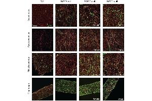 Elevated collagen levels in skeletal muscles in SGCA- and SGCD-null mice and in the heart of SGCD-null mice investigated using ABIN135046: Immunofluorescent images of skeletal muscles stained with collagen type I (fibrotic marker, green) and laminin (extracellular matrix of muscle fibres, red) Scale bar: 100 μm.