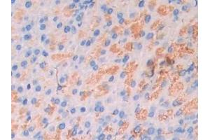 Detection of CA7 in Mouse Pancreas Tissue using Polyclonal Antibody to Carbonic Anhydrase VII (CA7)