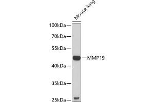 Western blot analysis of extracts of mouse lung, using MMP19 antibody (ABIN6132357, ABIN6143908, ABIN6143909 and ABIN6222356) at 1:1000 dilution. (MMP19 anticorps  (AA 209-508))
