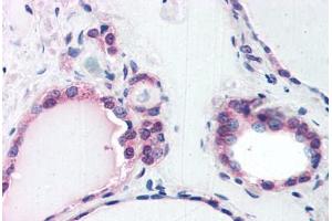 Human Thyroid (formalin-fixed, paraffin-embedded) stained with COPS2 antibody ABIN351473 at 3. (COPS2 anticorps  (AA 439-451))