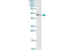 TRIP6 (Human) IP-WB Antibody Pair