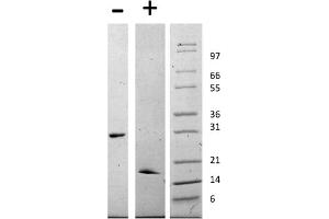 SDS-PAGE of Human Glial Derived Neurotrophic Factor Recombinant Protein SDS-PAGE of Human Human Glial Derived Neurotrophic Factor Recombinant Protein. (GDNF Protéine)
