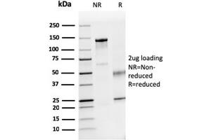 SDS-PAGE Analysis Purified Dystrophin Monospecific Mouse Monoclonal Antibody (DMD/3241). (Dystrophin anticorps  (AA 114-263))