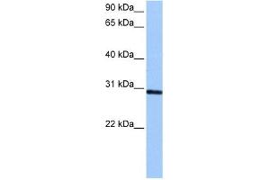 ASB11 antibody used at 0. (ASB11 anticorps  (C-Term))