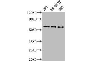 Western Blot Positive WB detected in: 293 whole cell lysate, SH-SY5Y whole cell lysate, U87 whole cell lysate All lanes: SLC11A2 antibody at 3 μg/mL Secondary Goat polyclonal to rabbit IgG at 1/50000 dilution Predicted band size: 63, 62, 65, 66 kDa Observed band size: 63 kDa