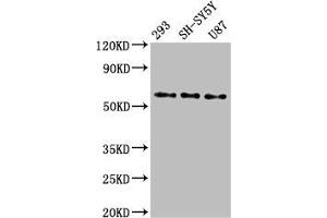 Western Blot Positive WB detected in: 293 whole cell lysate, SH-SY5Y whole cell lysate, U87 whole cell lysate All lanes: SLC11A2 antibody at 3 μg/mL Secondary Goat polyclonal to rabbit IgG at 1/50000 dilution Predicted band size: 63, 62, 65, 66 kDa Observed band size: 63 kDa (SLC11A2 anticorps  (AA 1-69))