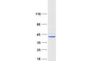 Validation with Western Blot