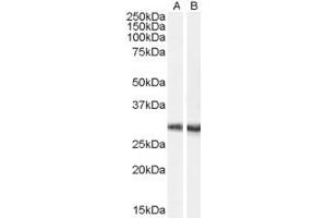 Western Blotting (WB) image for anti-Carboxylesterase 4A (CES4A) (C-Term) antibody (ABIN2790977) (CES4A anticorps  (C-Term))
