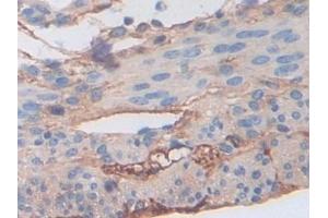 Detection of FGB in Mouse Uterus Tissue using Polyclonal Antibody to Fibrinogen Beta Chain (FGB)