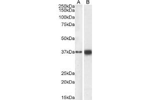 ABIN6391384 (0. (SOX2 anticorps  (N-Term))