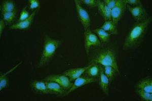 IF analysis of DBI using anti-DBI antibody (ABIN4886558). (Diazepam Binding Inhibitor anticorps  (AA 2-87))