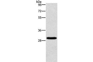 Western Blot analysis of Hela cell using BCL10 Polyclonal Antibody at dilution of 1:950 (BCL10 anticorps)