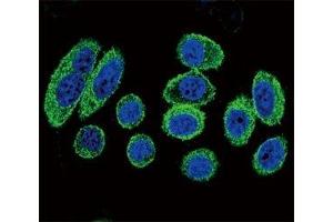 Confocal immunofluorescent analysis of alpha Actin antibody with A549 cells followed by Alexa Fluor 488-conjugated goat anti-rabbit lgG (green).