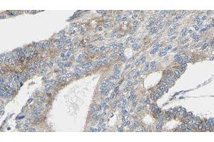 ABIN6276954 at 1/100 staining Human prostate tissue by IHC-P. (Peroxiredoxin 2 anticorps  (C-Term))