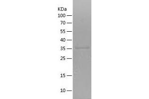 Western Blotting (WB) image for Met Proto-Oncogene (MET) (AA 956-1080) protein (His-IF2DI Tag) (ABIN7123920)