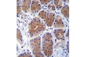 anti-Mid1-Interacting Protein 1 (m1ip1) (N-Term) antibody