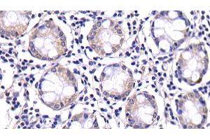 Detection of CASP8 in Human Colon Tissue using Polyclonal Antibody to Caspase 8 (CASP8)