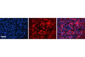 Rabbit Anti-ATP1B1 Antibody   Formalin Fixed Paraffin Embedded Tissue: Human Liver Tissue Observed Staining: Plasma membrane and cytoplasm in hepatocytes Primary Antibody Concentration: 1:100 Other Working Concentrations: N/A Secondary Antibody: Donkey anti-Rabbit-Cy3 Secondary Antibody Concentration: 1:200 Magnification: 20X Exposure Time: 0.