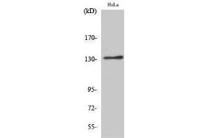 Western Blotting (WB) image for anti-Integrin alpha V (ITGAV) (Internal Region) antibody (ABIN3175673) (CD51 anticorps  (Internal Region))