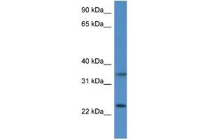 Mouse Thymus; WB Suggested Anti-Cyb5r1 Antibody. (CYB5R1 anticorps  (N-Term))
