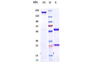 Anti-IL-4Ra / CD124 Reference Antibody (dupilumab) on SDS-PAGE under reducing (R) condition. (Recombinant IL-4RA (Dupilumab Biosimilar) anticorps)