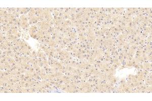 Detection of PRAME in Human Liver Tissue using Polyclonal Antibody to Preferentially Expressed Antigen In Melanoma (PRAME) (PRAME anticorps  (AA 416-502))