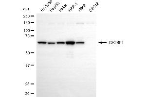 anti-Insulin-Like Growth Factor 2 mRNA Binding Protein 1 (IGF2BP1) antibody