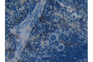 DAB staining on IHC-P; Samples: Mouse Spleen Tissue