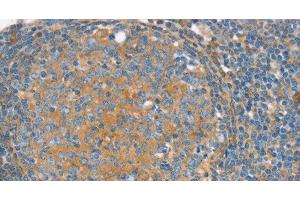Immunohistochemistry of paraffin-embedded Human tonsil using SNX3 Polyclonal Antibody at dilution of 1:30 (Sorting Nexin 3 anticorps)