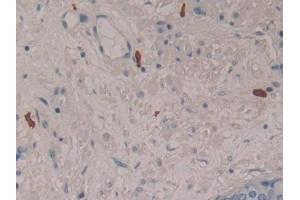 anti-Liver Expressed Antimicrobial Peptide 2 (LEAP2) (AA 23-76) antibody