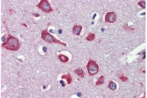 Human Brain, Cortex (formalin-fixed, paraffin-embedded) stained with CHRNA7 antibody ABIN462402 followed by biotinylated secondary antibody, alkaline phosphatase-streptavidin and chromogen. (CHRNA7 anticorps)
