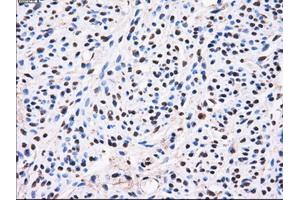Immunohistochemical staining of paraffin-embedded liver tissue using anti-AKR1A1mouse monoclonal antibody. (AKR1A1 anticorps)