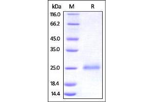 Human CD99, His Tag on SDS-PAGE under reducing (R) condition. (CD99 Protein (CD99) (AA 23-122) (His tag))