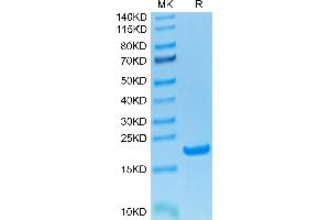 Human CD20 on Tris-Bis PAGE under reduced condition.